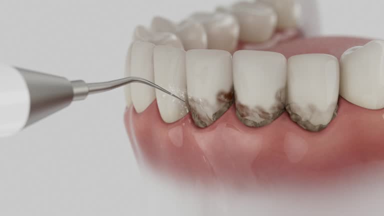 Reliable Tooth Extraction contractor in Willowbrook, CA by Smile Center Dentistry